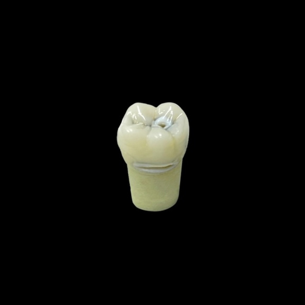 Educational Caries Teeth