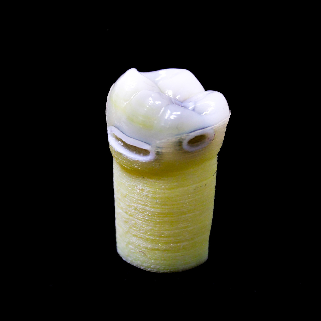 Photo of Educational caries Teeth #19
