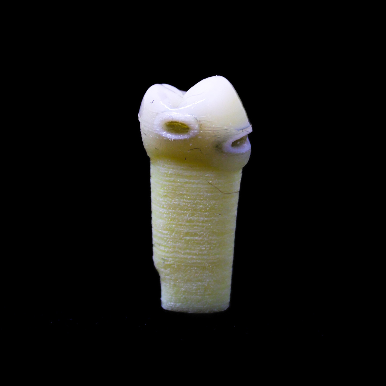 Photo of Educational caries Teeth #20