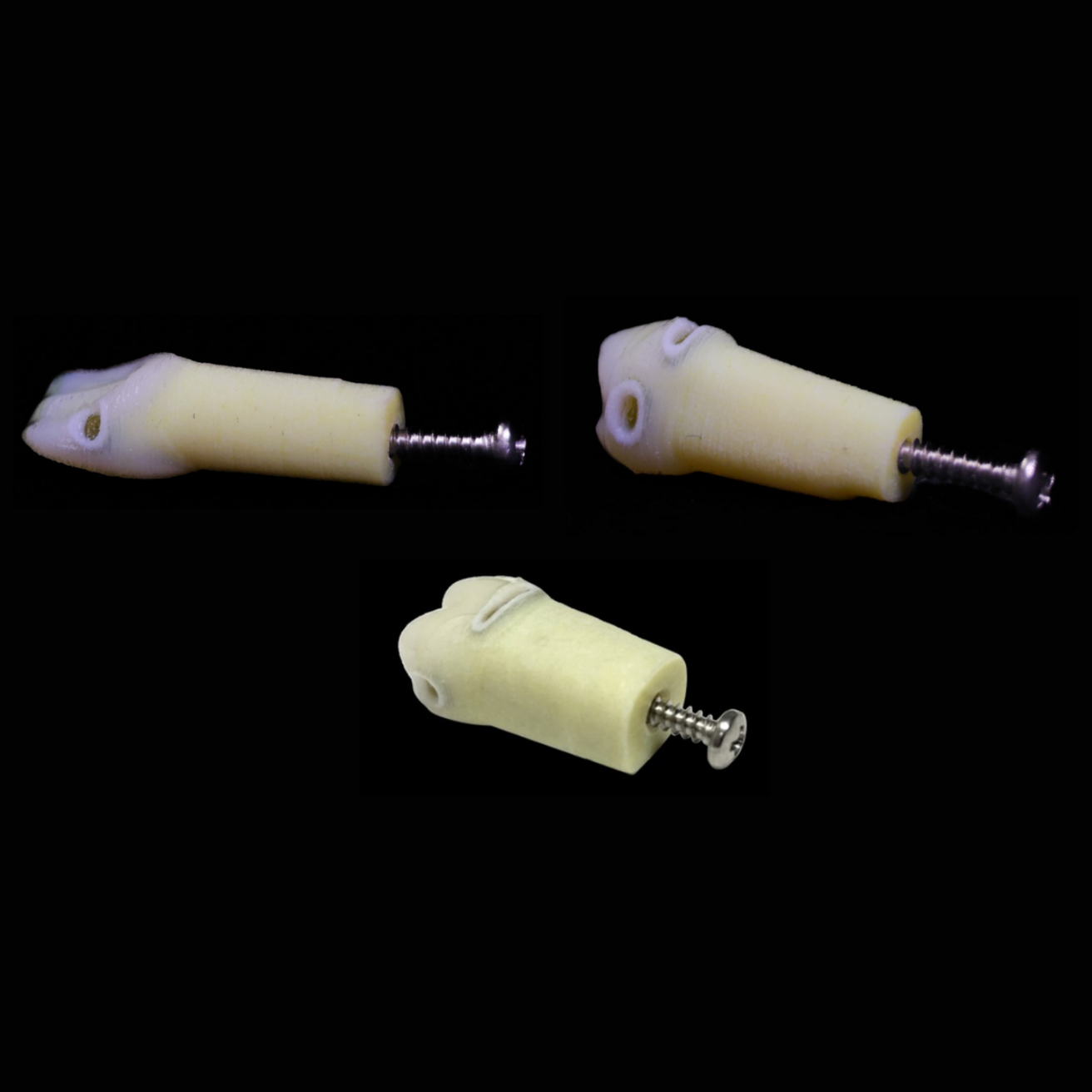 all ect teeth