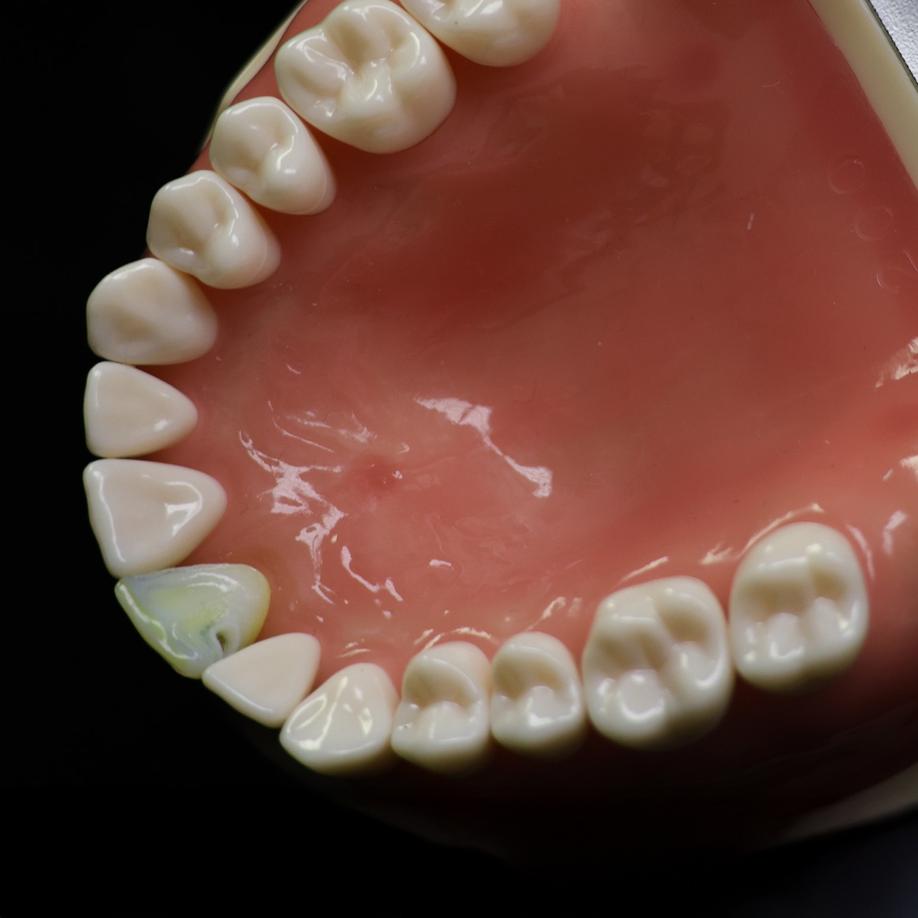ECT8-mouth.jpg