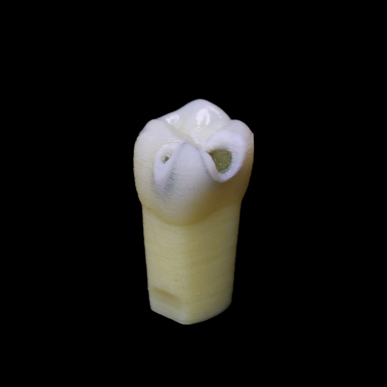 Image of ECT #14