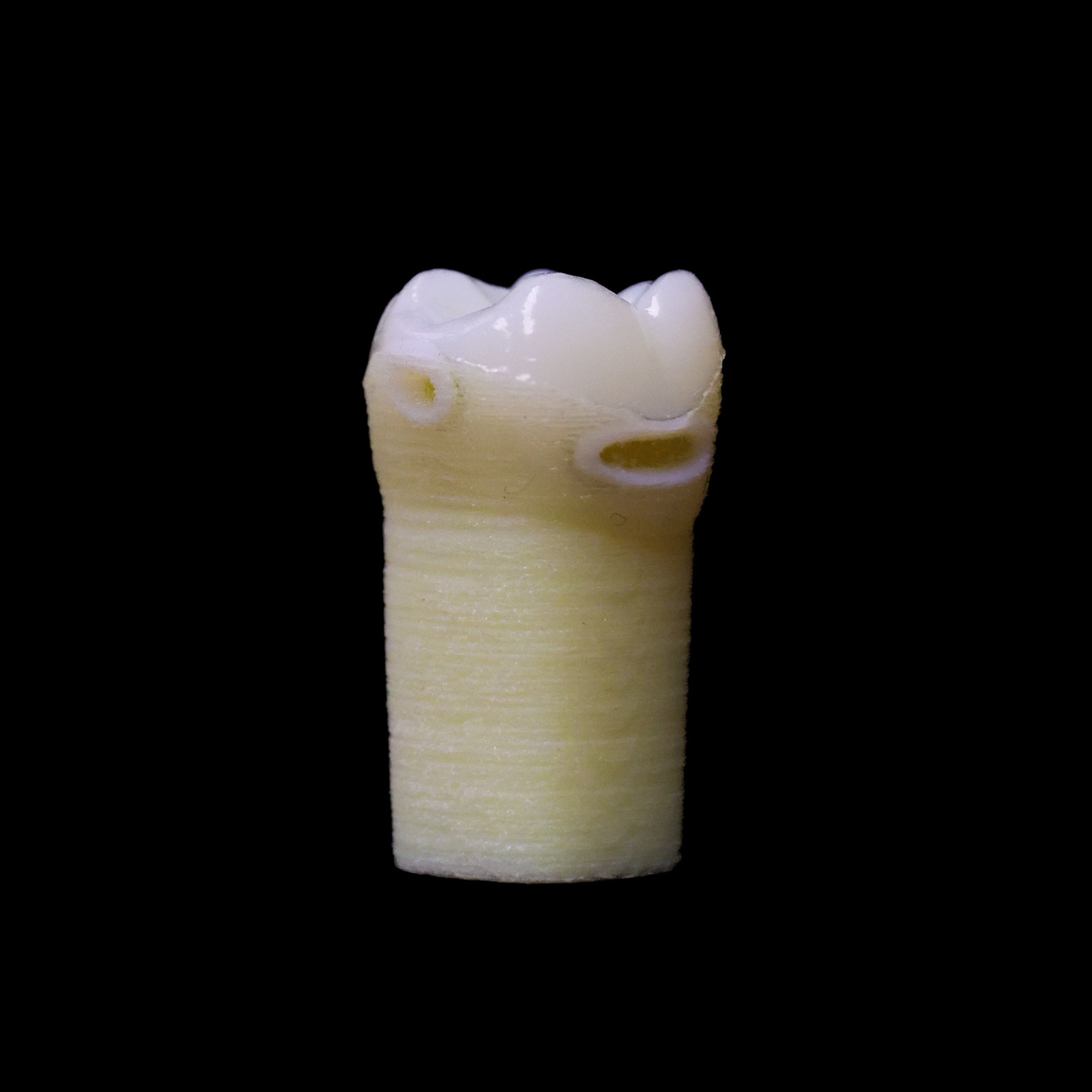 Image of ECT #03
