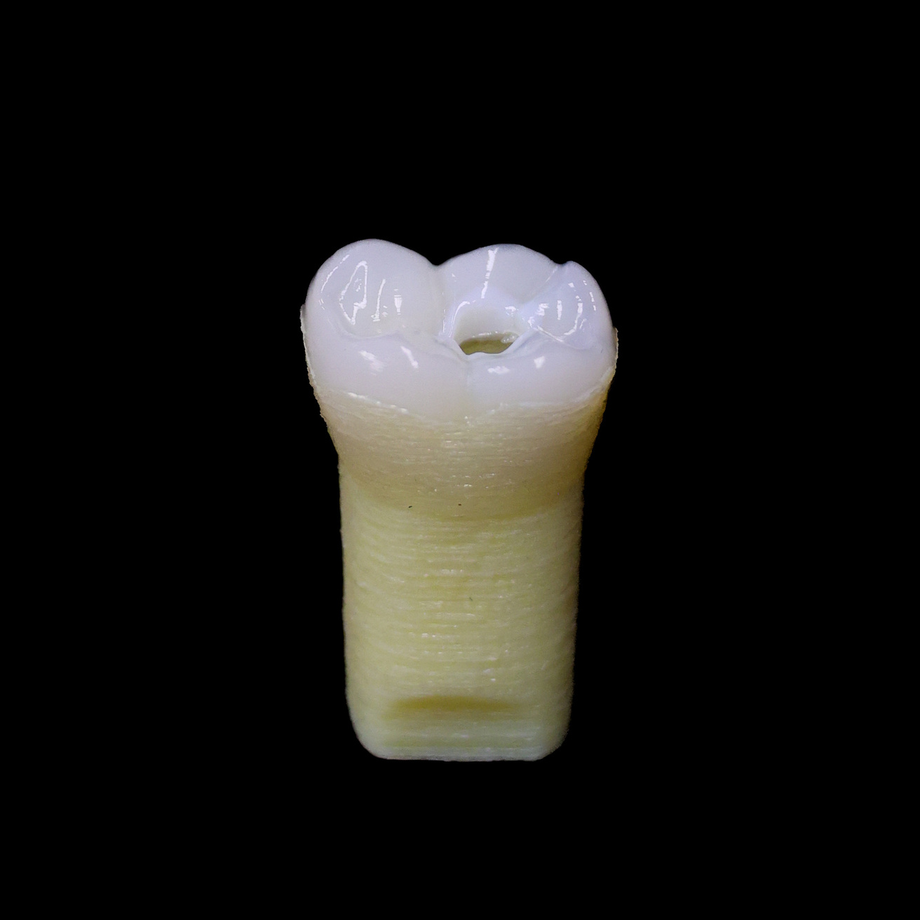 Image of ECT #30
